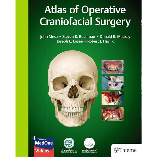 Atlas of Oculoplastic and Orbital Surgery: 9781496390813: Medicine
